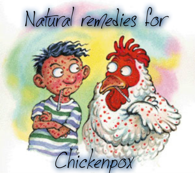 Chickenpox RTFC